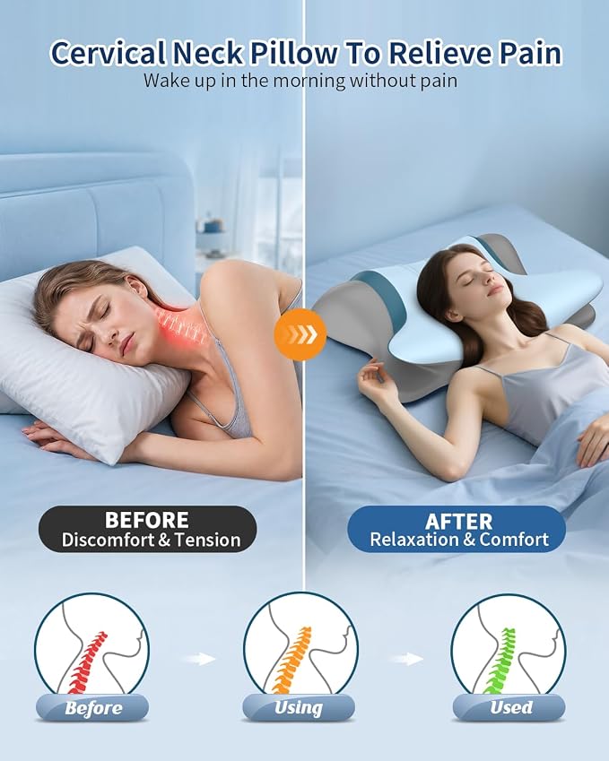 Cervical Neck Pillow for Pain Relief - Image 2